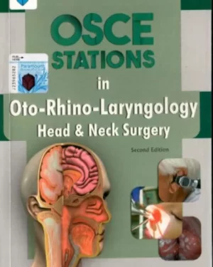 OSCE STATIONS IN OTO-RHINO-LARYNGOLOGY HEAD & NECK SURGRY 2nd edition by IQBAL HUSSAIN UDAIPURWALA