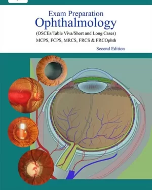 EXAM PREPARATION OPHTHALMOLOGY osce,table viva,short and long cases by m. saim khan