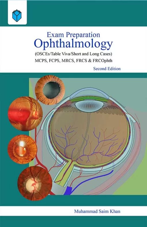 EXAM PREPARATION OPHTHALMOLOGY osce,table viva,short and long cases by m. saim khan