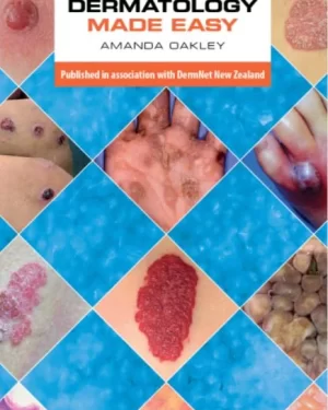 DERMATOLOGY MADE EASY PB by AMANDA OAKLEY