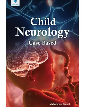 CHILD NEUROLOGY: CASE BASED BY MUHAMMAD SAEED